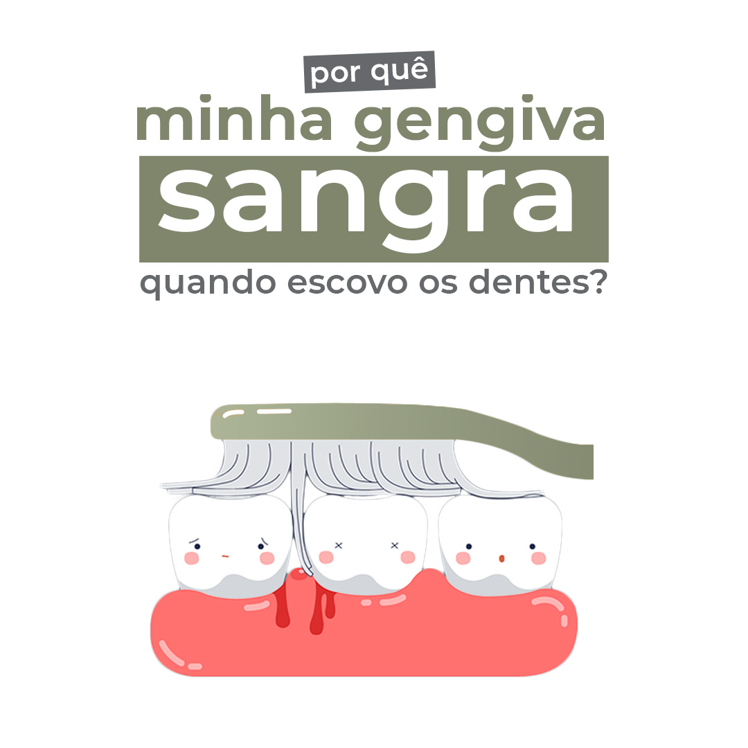 Leia mais sobre o artigo Por que minha gengiva sangra quando escovo os dentes?